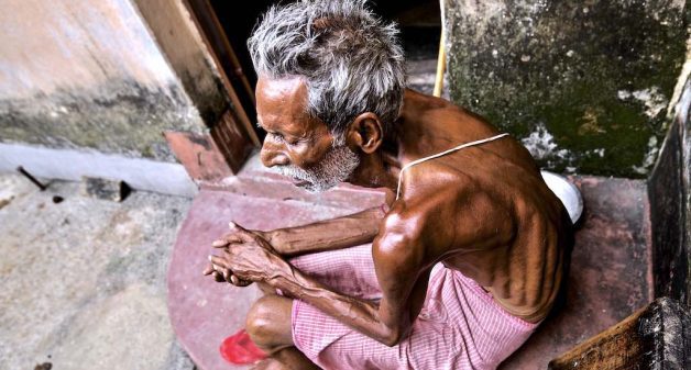 Fluorosis has crippled 68-year-old Himanshu Chakarbarty, a resident of high fluoride-affected Brahman Tola in Dhanbad district. (Photo by Eklavya Prasad)